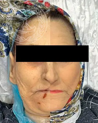 Танатопрактическая подготовка усопшего